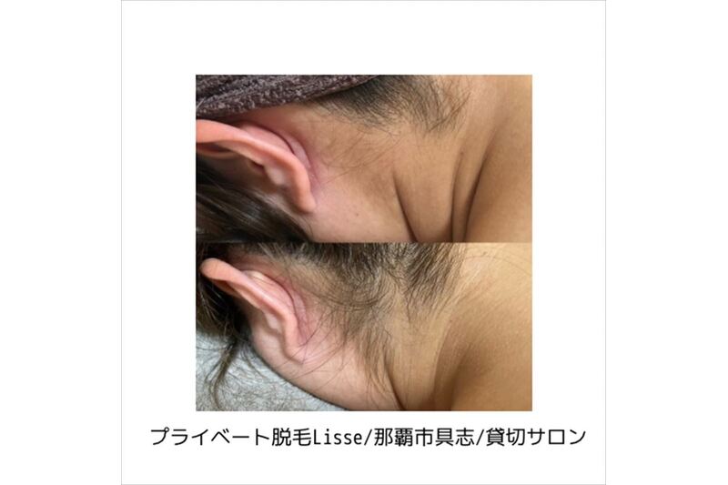 様々な薬剤の中から最適なものを選びます